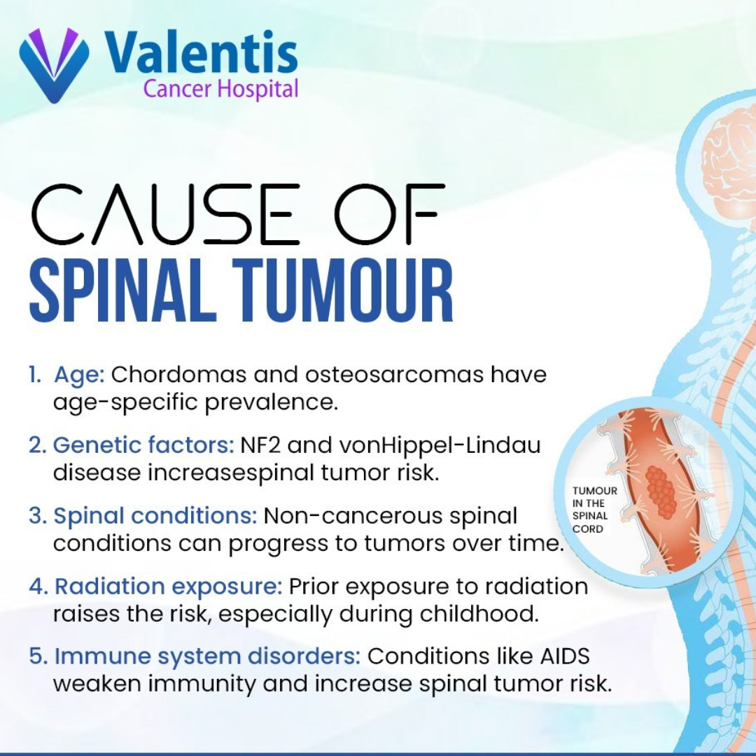 Spine Tumor Treatment in Meerut