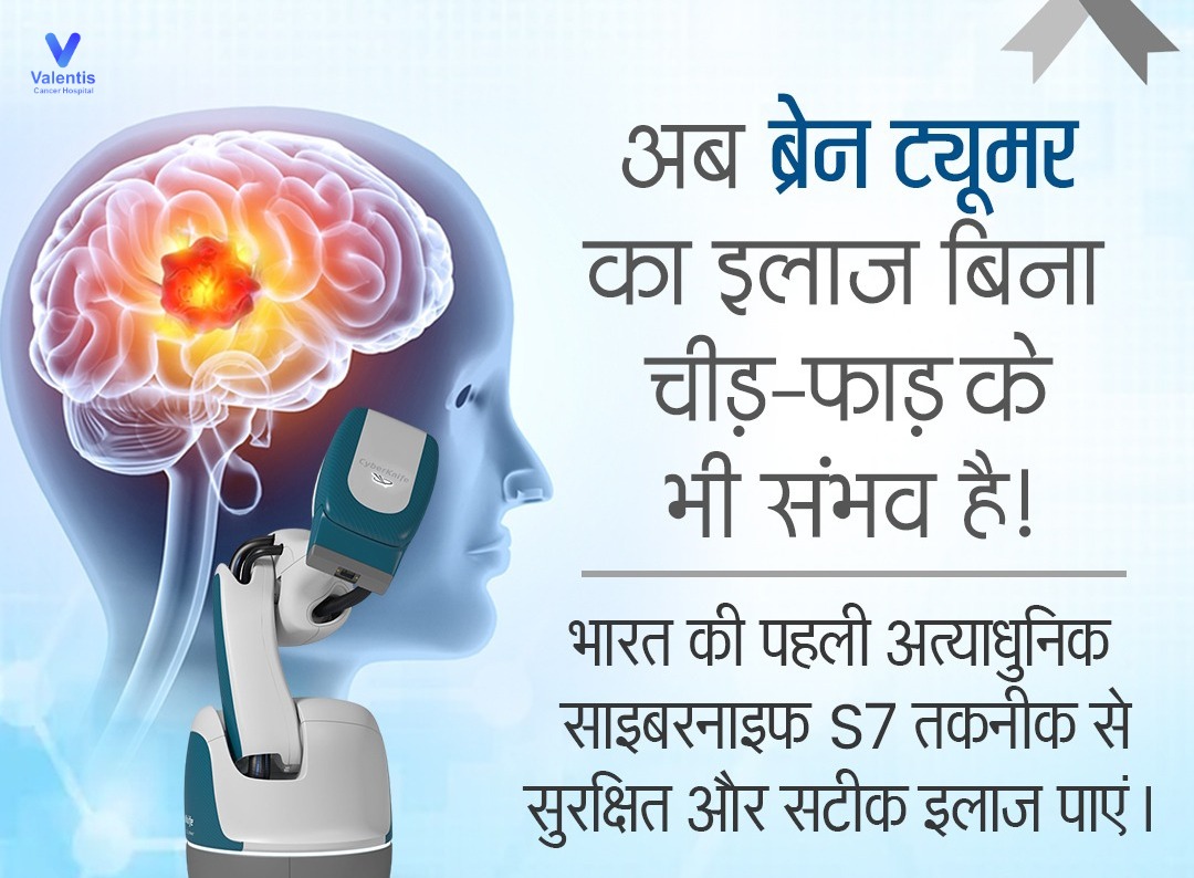 Brain Tumor Treatment in Meerut